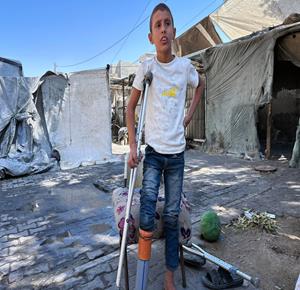 غزة - الطفل راتب اقليق (10 أعوام) يعيش مع جده داخل خيمة في دير البلح بعد أن فقد والدته وشقيقه جراء القصف خلال زيارته لهما في خانيونس، يستخدم راتب أنبوب صرف صحي كبديل عن طرف صناعي لمساعدته على الحركة بعد أن أصيب في القصف ذاته وبترت ساقه في وقت يحتاج فيه إلى تركيب طرف صناعي ورعاية طبية وتأهيل عاجل، وسط النقص الحاد في المعدات الطبية جراء استمرار الحرب