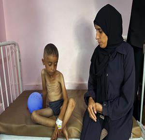 غزة - أطفال بمستشفى ناصر في خان يونس جنوب قطاع غزة يتلقون العلاج جراء أمراض جلدية وسوء التغذية مع استمرار العدوان والحصار الإسرائيلي
